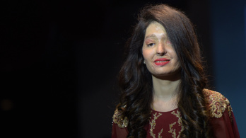 Savas támadásban elcsúfított arcú nők tartottak divatbemutatót Indiában