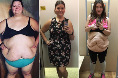 Női fogyás átalakulások. Elképesztő sikersztori - 40 kilótól szabadult meg