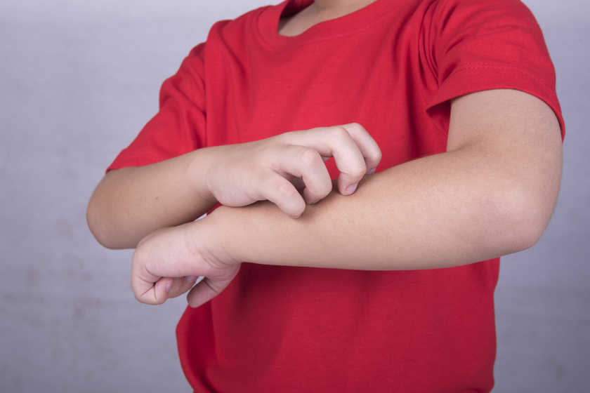 Nemcsak a hidegtől lehet száraz a gyerek bőre: fontos jelzés a szervezettől