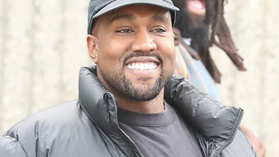 Mi történik Kanye West arcával?