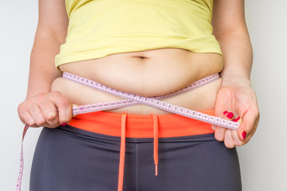zsírégetést a has körül súlycsökkenés után rosszabbak a striák