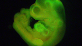 Már nem kellenek hímivar- és petesejtek: mesterséges embriókat hoztak létre Hollandiában