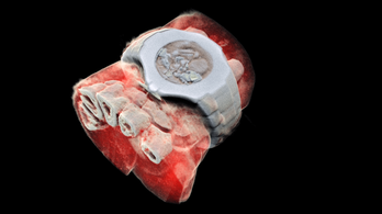 Az első színes 3D emberi röntgenfelvétel