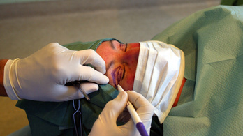 Egyre többen mennek plasztikai sebészhez, hogy úgy nézzenek ki, mint a szelfiken