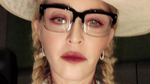 Madonna meglepően előnytelen szelfiket posztol mostanában