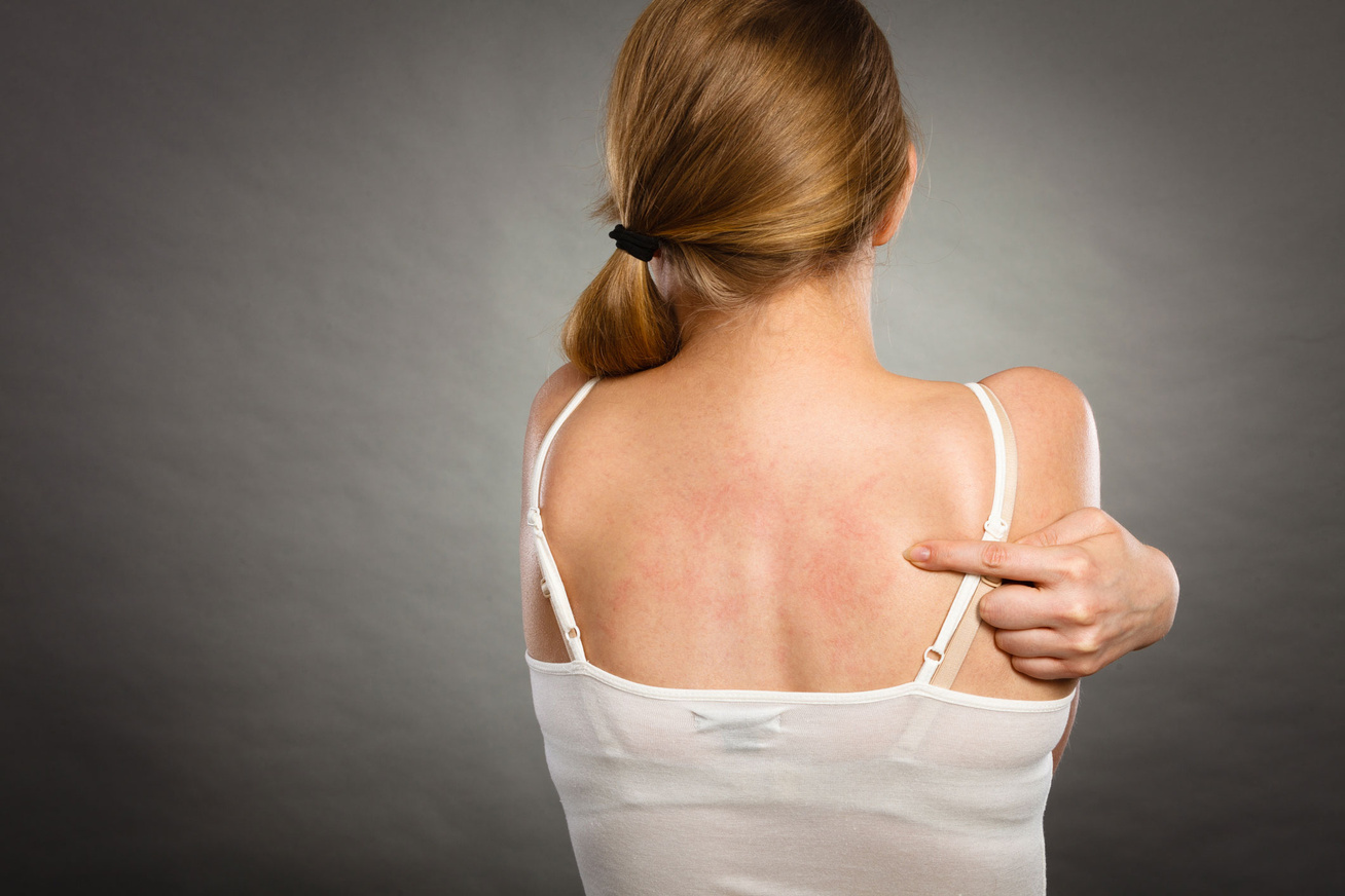 8 árulkodó jel, ami ritka allergiára utal