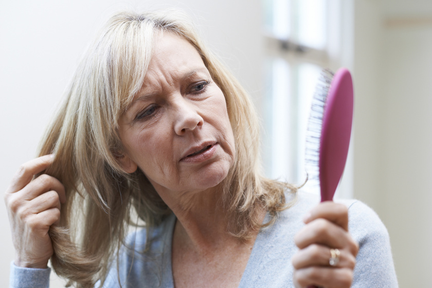 Így mutatja meg a hajad a pajzsmirigy-alulműködést - Kevesen ismerik fel a tüneteket