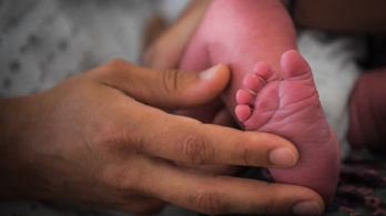 Végtaghiánnyal született csecsemők rejtélye tartja lázban Franciaországot
