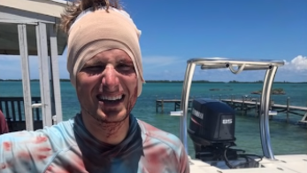 Megharapta a fejét egy cápa a Bahamákon, de túlélte
