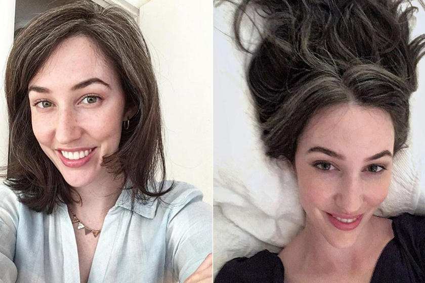 14 évesen kezdett őszülni, és betelt nála a pohár - Az Instagramon indított hadjáratot a hajfestés ellen