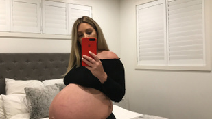 Túl nagy hasa miatt aláztak meg egy terhes nőt