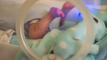 Ombudsman: A kórházban nem lehet csak úgy elválasztani az újszülöttet édesanyjától