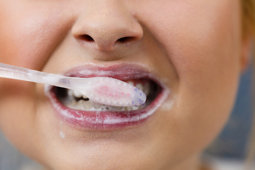 Népszerű házi fogfehérítő, de nagyon káros - A fogorvos szerint erősen roncsolja a zománcot