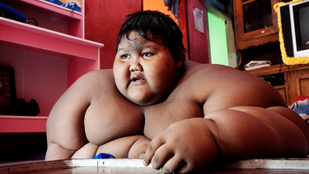 100 kilót fogyott a világ legkövérebb gyereke