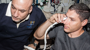 Az űrhajósok látásproblémáit az agyukba tóduló víz okozhatja