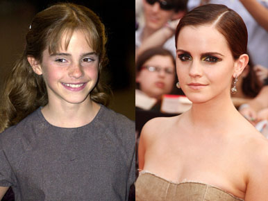 Így lett Emma Watson kislányból jó nő