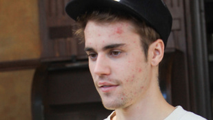 Így néz ki Justin Bieber smink/retus nélkül