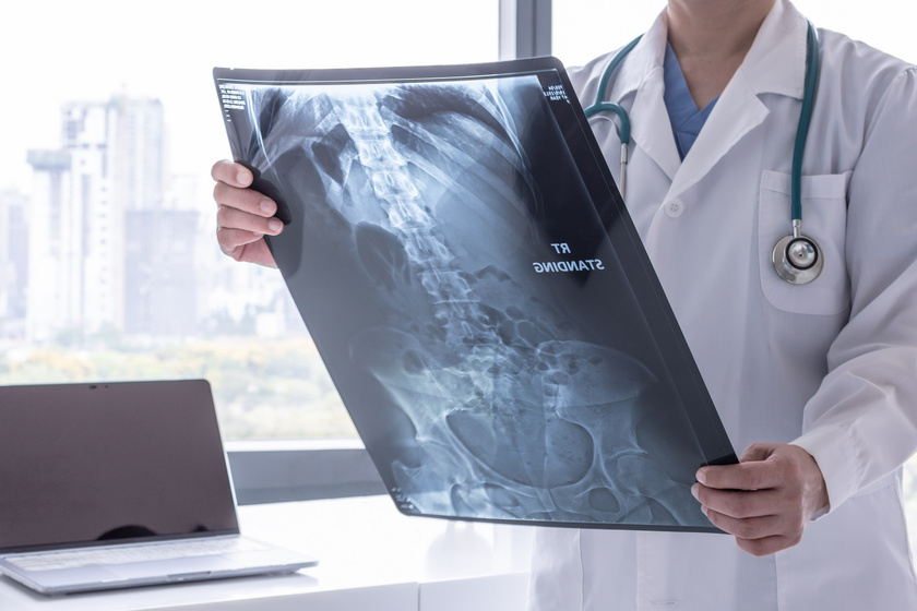 Hihetetlen, mit találtak az ember gyomrában: a röntgenfelvétel láttán az orvosok is ledöbbentek