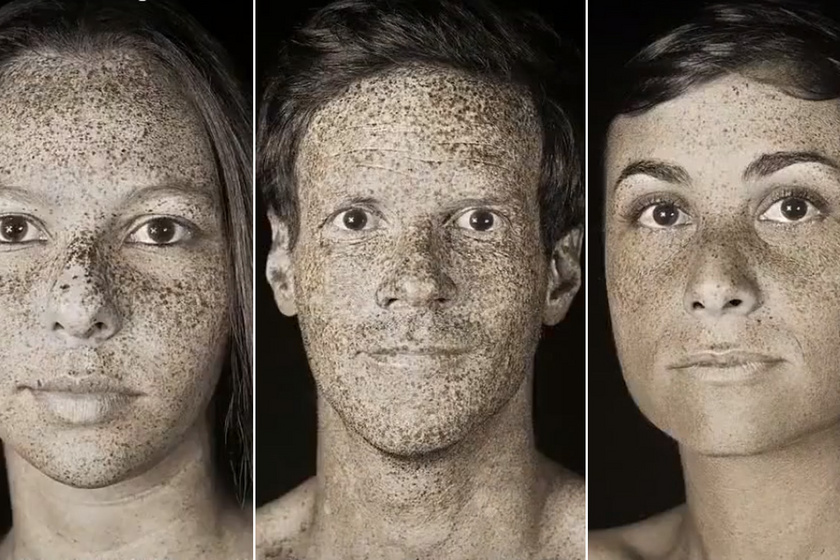 Hihetetlen képeken mutatta meg az UV-sugarak hatását a fotós: megdöbbentő, hogy hatnak a bőrre