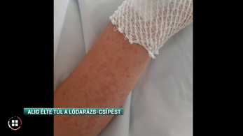 Tizennégy éves fiú mentette meg egy allergiás kislány életét