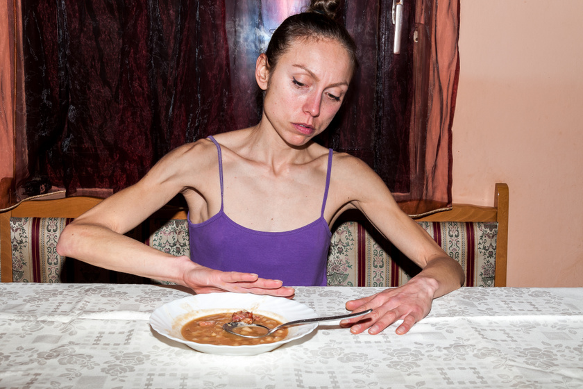 Az anorexia nem úri huncutság, hanem súlyos betegség: 10 bátor ember, aki megmutatta, hogy van kiút