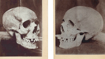 Egy skót múzeum kéri vissza a 18. századi boszorkány ellopott csontjait