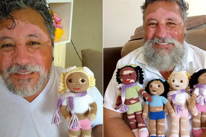 Olyan babákat készít a nagypapa, amilyeneket máshol nem kapni: vitiligós játékaival segít a gyerekeknek