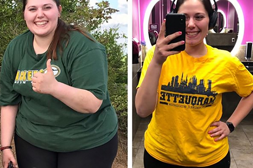 70 kilót fogyott 2 év alatt a fiatal nő: egy természetes módszer segített neki