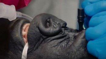 Szürkehályogműtétet végeztek egy gorillán