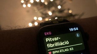 Zsolt karácsonyra egy Apple Watch 5-ot kapott, ez mentette meg az életét