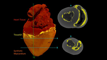 Bionikus szív segíthet a mesterséges szívbillentyűk tesztelésével