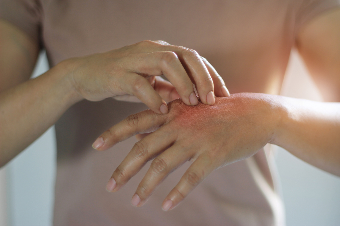 az ujj kiütésének kezelése hogyan lehet az ízületek izomfájdalmait gyorsan enyhíteni