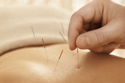 Hogy segíthet az akupunktúra a fogyásban? A szakértő válaszol