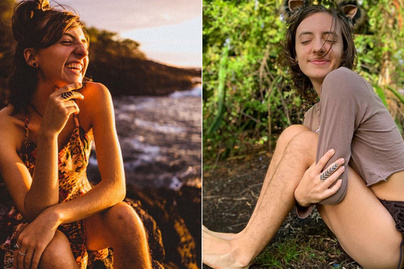 Így néz ki egy 3 éve nem borotvált női láb: megbotránkozott a fél világ, amikor a 19 éves nő megmutatta