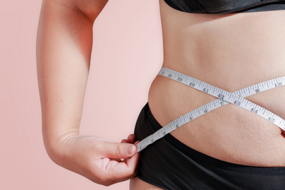 Tudod, mennyi zsírsejted van? 3 érdekes infó, amit még biztos nem hallottál a testedről