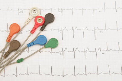 Mikor nem elég az egyszerű EKG-vizsgálat? 11 kérdés, amire kardiológusok adják meg a választ