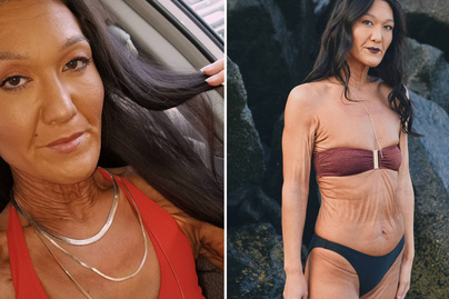 29 évesen egy idős nő testébe zárva él a modell: fotókon mutatjuk, hogyan ad erőt másoknak