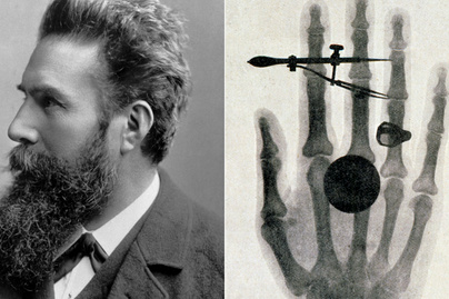 Véletlenül fedezték fel a viagrát és a röntgengépet: 4 érdekes történet az orvostudományból