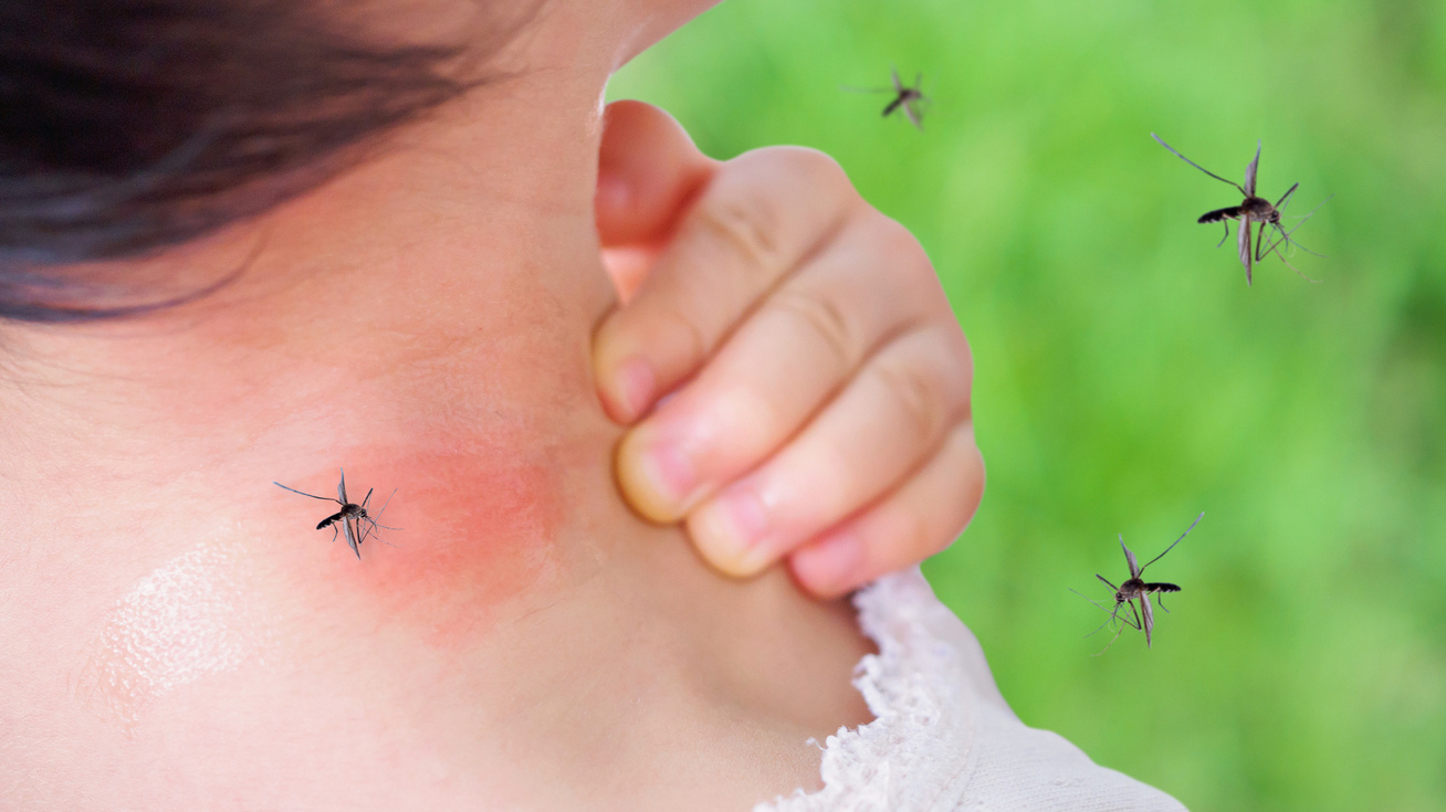 Hogyan talál meg a szúnyog? | Startlap Wiki