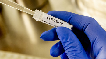 Áttörést hozhat egy új Covid-19 teszt