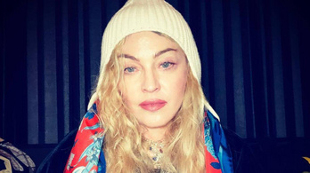Madonna elkapta a vírust, de szerinte már rég túl van rajta