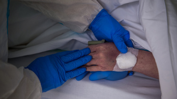 Levettek a lélegeztetőgépről egy idős koronavírusost a vérplazmaterápiának köszönhetően