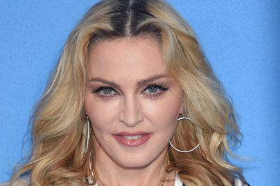 Madonna plasztikáztatott? Friss fotója jó okot ad a gyanúra