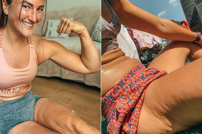Ilyen valójában egy fitneszblogger teste: retusálatlan fotókon mutatja meg a nő, hogy senki sem tökéletes