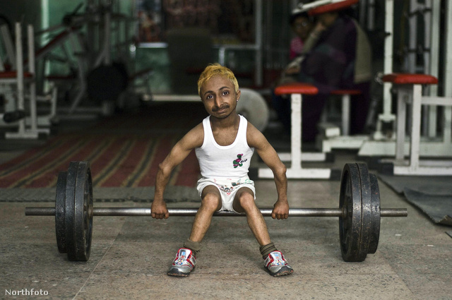  A Dev életéért küzdő orvos, Neraj Chandan vérzéssel és agyi aneurizmával magyarázta a testépítő halálát. Aditya Romeo Dev a Guinness Rekordok Könyvébe is bekerült azzal, hogy kilenckilónyi testsúlya ellenére képes volt felemelni egy 1,5 kilós súlyzót.