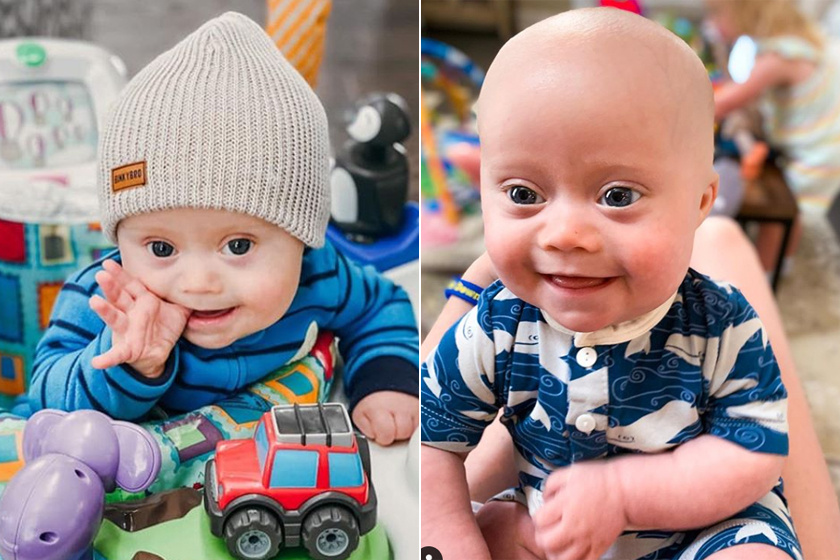 Cuki modell lett a Down-szindrómás babából: az Instagram új sztárja az egyéves Emmett