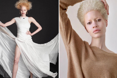 albino-modell