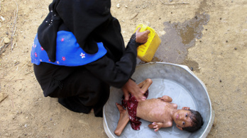 UNICEF: Gyerekek millióit fenyegeti az éhínség Jemenben