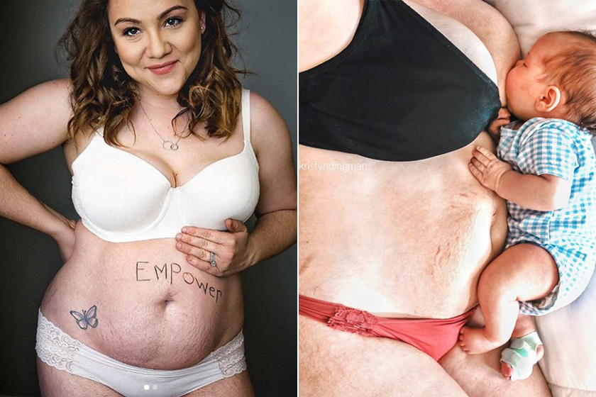 Így néz ki a női test szülés után - Az anya kendőzetlenül őszinte fotókon mutatja meg