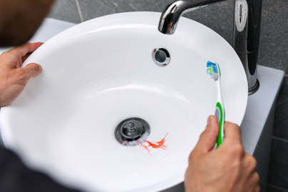 Étkezés után nem szabad azonnal fogat mosni: így hatnak a savak a fogzománcra